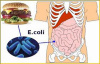 Кишечная палочка Е.coli, штамм О104:Н4.