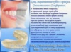 Капа, выравнивание зубов и прикуса. Cтоматология Симферополь.