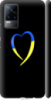 Чехол на Vivo • Жёлто-голубое сердце 885m-2375