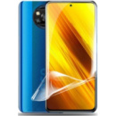 Pocophone Захисна гідрогелева плівка DM для Xiaomi Poco X3/X3 Pro Глянцева (Код товару:1579)