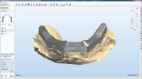 Abutment Designer and Implant Bar and Bridge Design Package