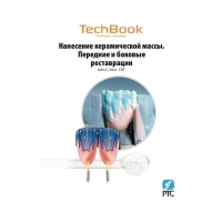 Нанесение керамической массы John C. Ness CTD