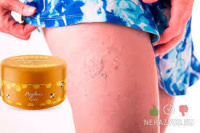 Медовый спас - Крем от варикоза, тромбоза