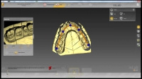 Программное обеспечение inLab SW (Ин Лаб СВ) Лицензия модуля временных протезов inLab SW 15.0