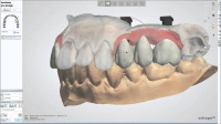 Dental System™ Crown & Bridge